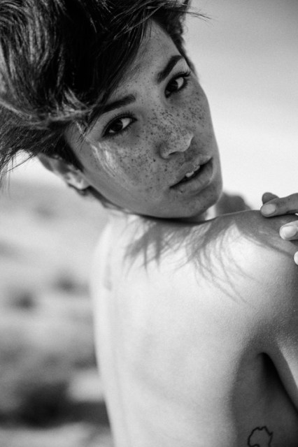 freckles-2