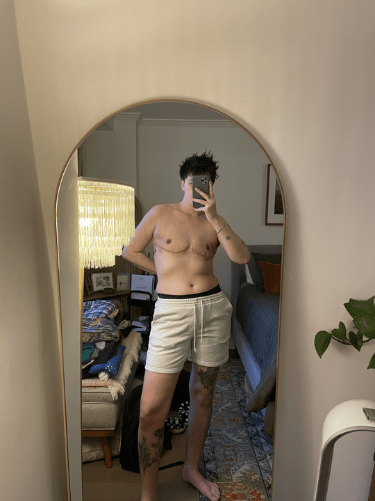 The author Motti shirtless in a mirror pic displaying their top surgery scars